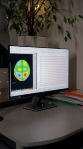 Monitor komputera z wizualizacją mapy aktywności mózgu i wynikami badania EEG w gabinecie diagnostycznym.